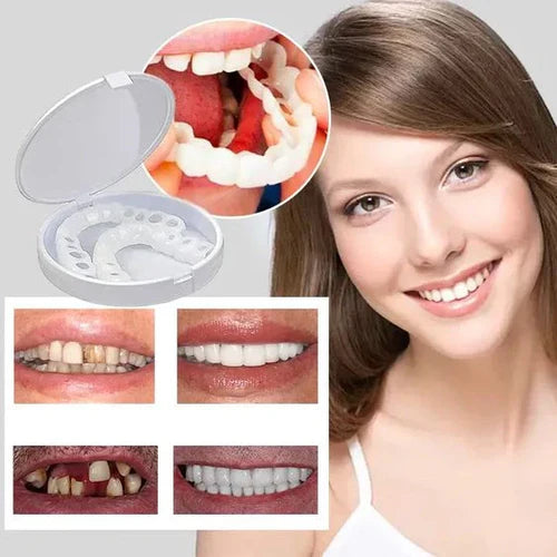 Carillas Dentalles Snap On Smile - 🦷 ¡Transforma tu sonrisa en segundos sin gastar una fortuna!